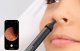 Otoskopo antgalių rinkinys Bebird ENT Kit, 3 vnt., juodas