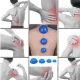 4Fizjo PRO+ Rubber Chinese Cupping Massage Set, 4 pcs, Blue