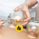 4Fizjo Glass Fire Cupping Set, 20 pcs