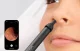 Otoskopo antgalių rinkinys Bebird ENT Kit, 3 vnt., juodas